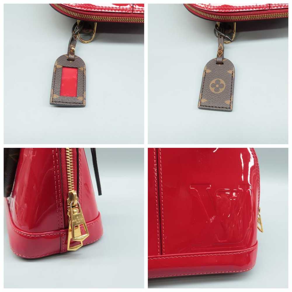 Louis Vuitton Alma patent leather satchel - image 11