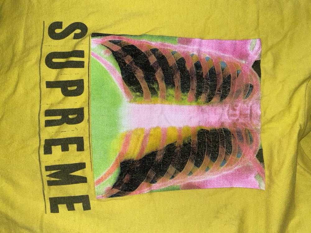 Supreme Supreme X-Ray Tee F/W 16 - image 3