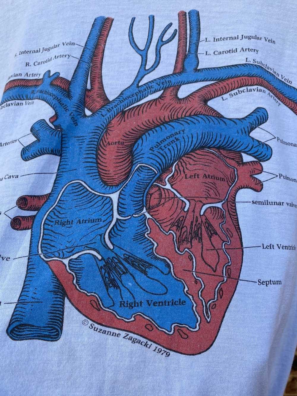 Vintage Vintage 1979 Anatomy of the Heart Graphic… - image 3