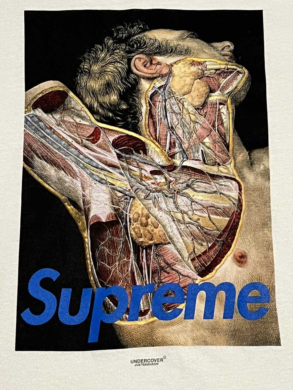 Hype × Streetwear × Supreme Supreme Undercover An… - image 3